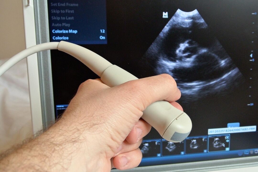 Ultraskaņa palīdzēs diagnosticēt sastrēguma prostatītu vīriešiem