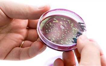 Baktērijas prostatas sekrēcijā